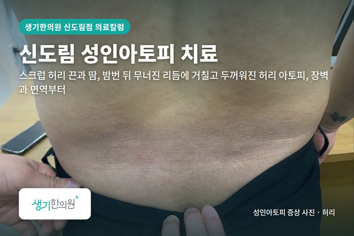 허리 성인아토피 증상 사진과 문구 「신도림 성인아토피 치료, 스크럽 허리 끈과 땀, 밤번 뒤 무너진 리듬에 거칠고 두꺼워진 허리 아토피, 장벽과 면역부터 · 생기한의원 신도림점」