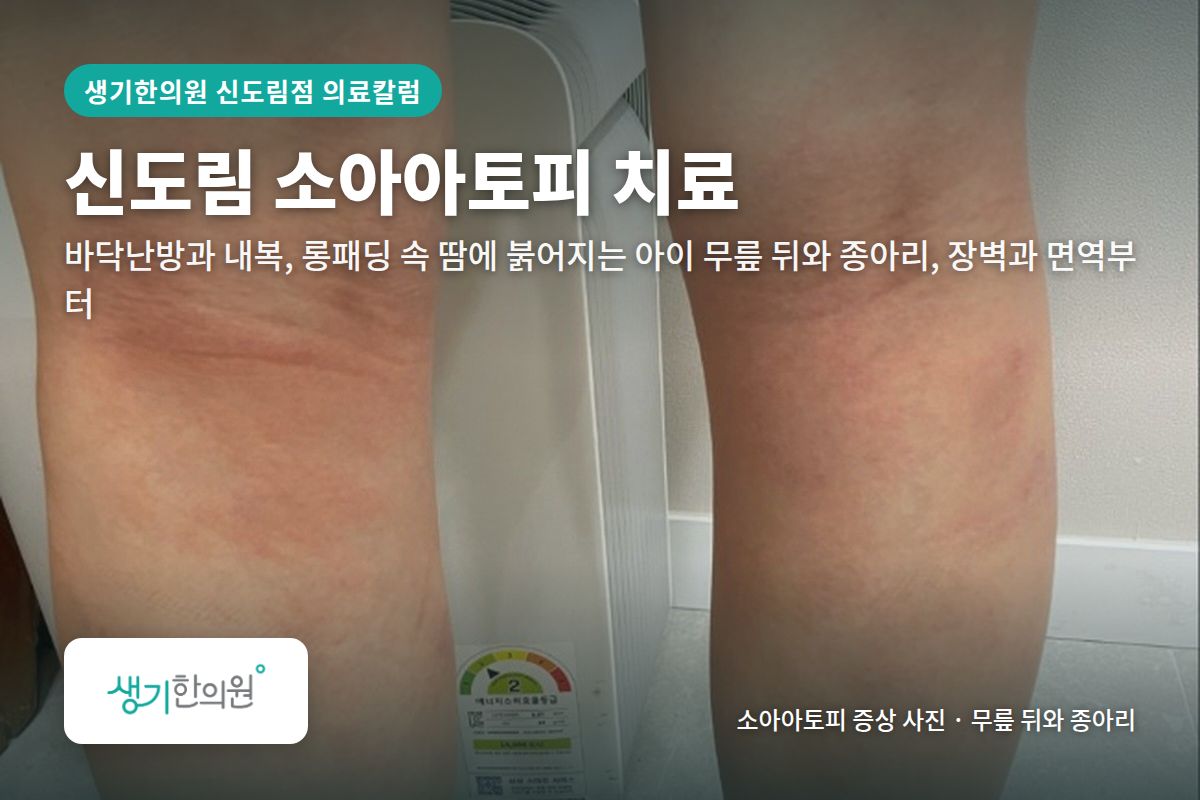 무릎 뒤와 종아리 소아아토피 증상 사진과 문구 「신도림 소아아토피 치료, 바닥난방과 내복, 롱패딩 속 땀에 붉어지는 아이 무릎 뒤와 종아리, 장벽과 면역부터 · 생기한의원 신도림점」