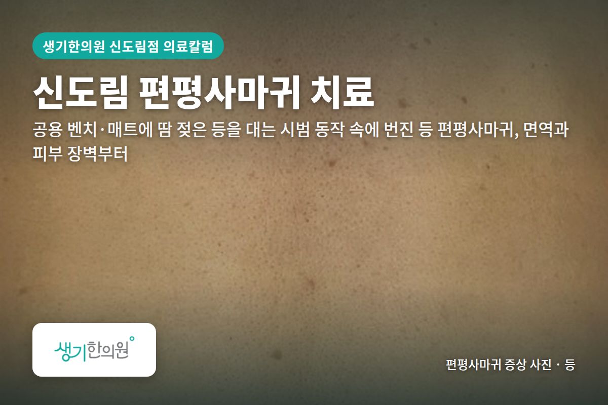 등 편평사마귀 증상 사진과 문구 「신도림 편평사마귀 치료, 공용 벤치·매트에 땀 젖은 등을 대는 시범 동작 속에 번진 등 편평사마귀, 면역과 피부 장벽부터 · 생기한의원 신도림점」