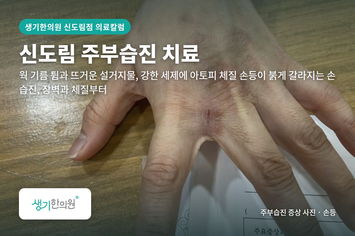 손등 주부습진 증상 사진과 문구 「신도림 주부습진 치료, 웍 기름 튐과 뜨거운 설거지물, 강한 세제에 아토피 체질 손등이 붉게 갈라지는 손 습진, 장벽과 체질부터 · 생기한의원 신도림점」