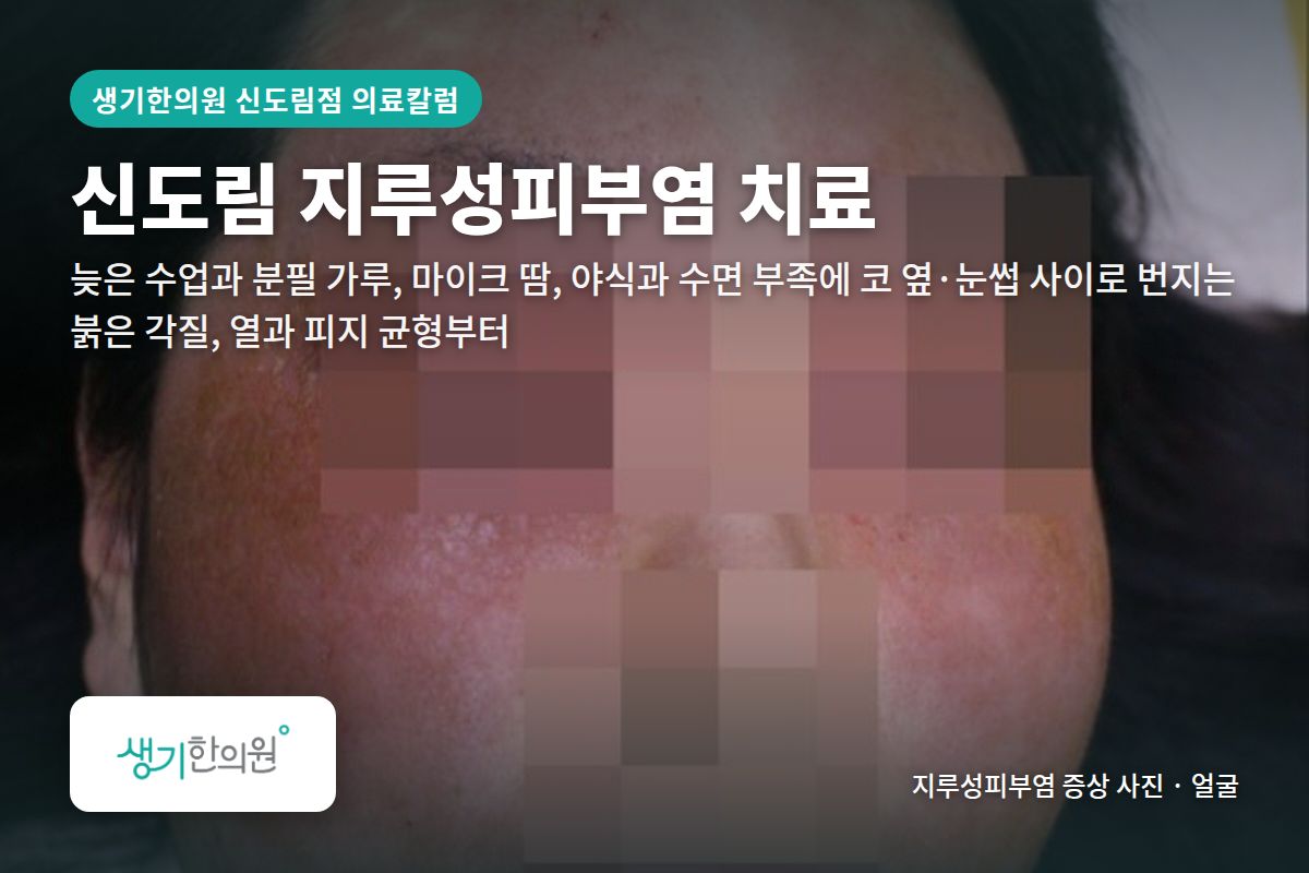 얼굴 지루성피부염 증상 사진과 문구 「신도림 지루성피부염 치료, 늦은 수업과 분필 가루, 마이크 땀, 야식과 수면 부족에 코 옆·눈썹 사이로 번지는 붉은 각질, 열과 피지 균형부터 · 생기한의원 신도림점」